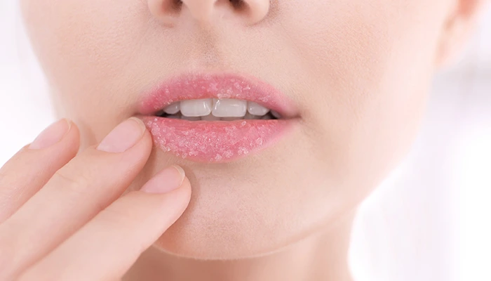 Opryszczka afty zajady usta leczenie